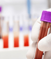 Glucose Fasting and PP Test
